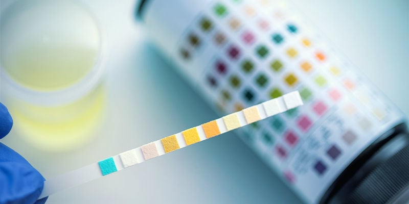 Testes de drogas no desporto: THC e CBD