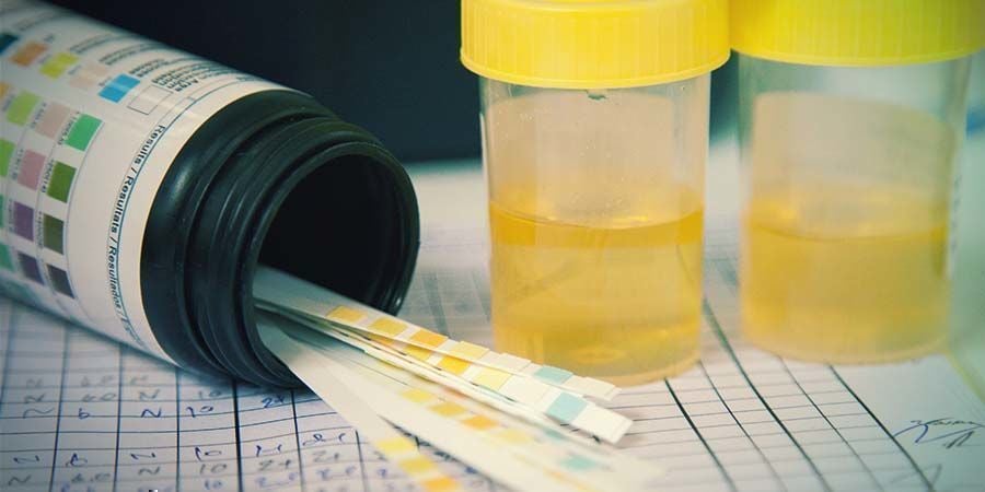 métodos de teste a drogas: Urina