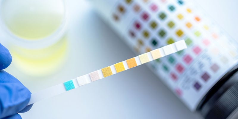 Como funcionam os testes de drogas ao THC?