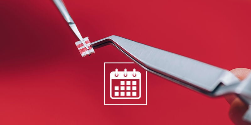 Durante quanto tempo se deve microdosear?