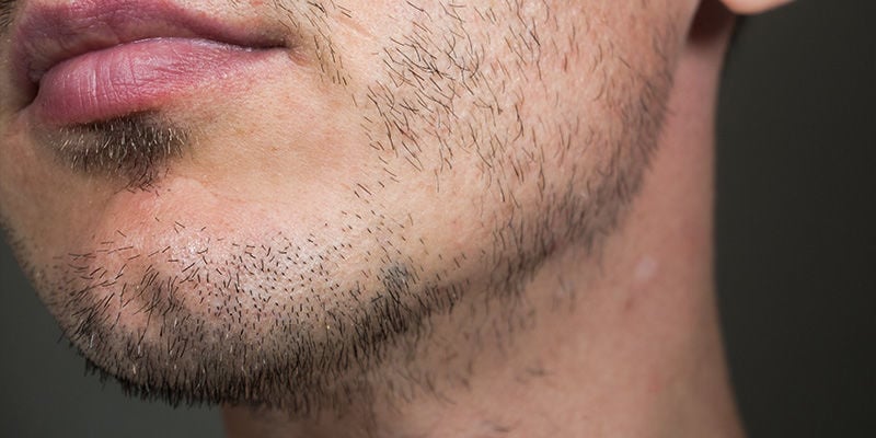 Canabinóides, Níveis de Testosterona e Crescimento Capilar