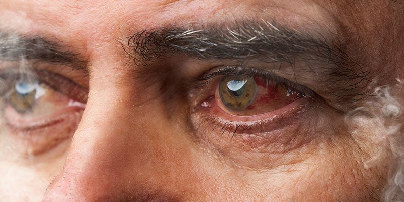 Porque razão a cannabis provoca olhos vermelhos?