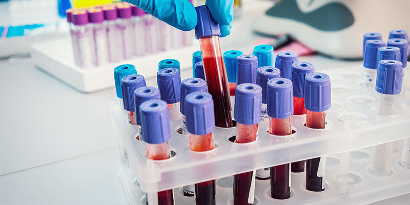 Testes de drogas em cabelo e sangue