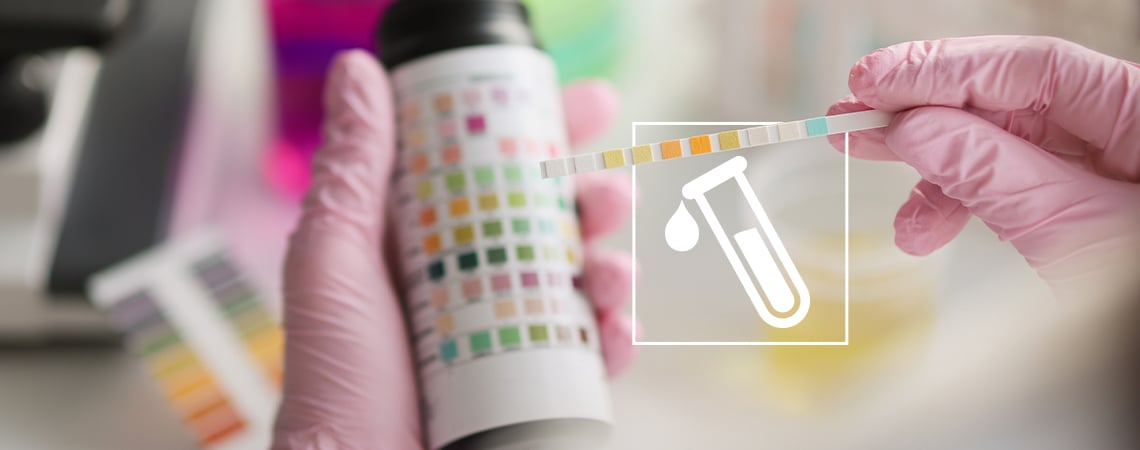 Does kratom show up on a drugs test?