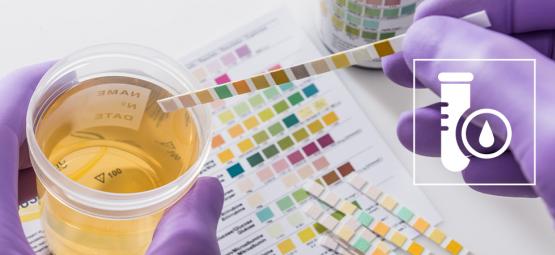 Como passar a um teste de drogas para THC (2025)